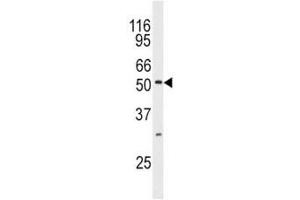 Western blot analysis of JNK3 antibody and mouse brain tissue lysate. (MAPK10 Antikörper  (AA 1-30))