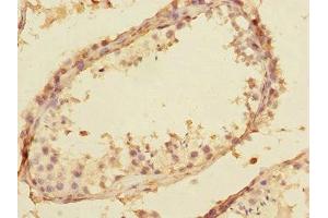 Immunohistochemistry of paraffin-embedded human testis tissue using ABIN7170630 at dilution of 1:100 (Splicing factor U2AF 26 kDa subunit (U2AF1L4) (AA 1-202) Antikörper)