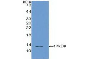 Detection of Recombinant S100A4, Human using Polyclonal Antibody to S100 Calcium Binding Protein A4 (S100A4) (s100a4 Antikörper  (AA 2-101))