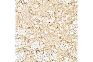 Immunohistochemistry (IHC) image for anti-Aquaporin 4 (AQP4) (AA 244-323) antibody (ABIN3016921)