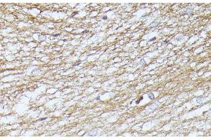 Immunohistochemistry of paraffin-embedded Rat brain using SEPT5 Polyclonal Antibody at dilution of 1:100 (40x lens). (Septin 5 Antikörper)