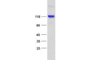 Western Blotting (WB) image for Bicaudal D Homolog 1 (BICD1) (Transcript Variant 1) protein (Myc-DYKDDDDK Tag) (ABIN2715261)