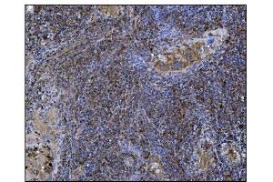 IHC analysis of POGLUT1 using anti-POGLUT1 antibody (ABIN7602910). (POGLUT1 Antikörper  (C-Term))