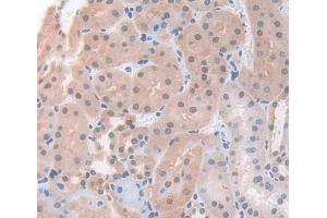 Used in DAB staining on fromalin fixed paraffin- embedded Kidney tissue (ACD Antikörper  (AA 21-175))