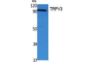 Western Blotting (WB) image for anti-Transient Receptor Potential Cation Channel, Subfamily V, Member 3 (TRPV3) (Internal Region) antibody (ABIN3187651)