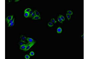 Immunofluorescent analysis of HepG2 cells using ABIN7167466 at dilution of 1:100 and Alexa Fluor 488-congugated AffiniPure Goat Anti-Rabbit IgG(H+L) (ERBB4 Antikörper  (AA 1027-1204))