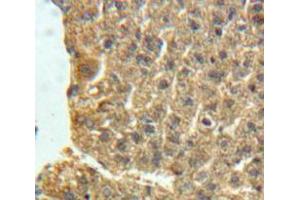 Used in DAB staining on fromalin fixed paraffin-embedded Liver tissue (NPX1 Antikörper  (AA 115-364))