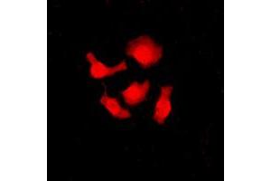 Immunofluorescent analysis of SRSF3 staining in HeLa cells. (SRSF3 Antikörper  (C-Term))