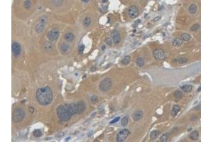 DAB staining on IHC-P; Samples: Human Esophagus (LGALS7 Antikörper  (AA 1-136))