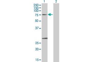 Western Blotting (WB) image for CAPN1 293T Cell Transient Overexpression Lysate(Denatured) (ABIN1331172)
