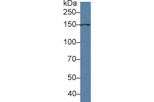 Anoctamin 6 Antikörper  (AA 744-824)