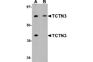 Western Blotting (WB) image for anti-Tectonic Family Member 3 (TCTN3) (C-Term) antibody (ABIN1030726) (TCTN3 Antikörper  (C-Term))