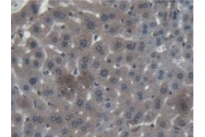 Detection of CTSF in Mouse Liver Tissue using Polyclonal Antibody to Cathepsin F (CTSF)