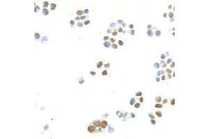 Immunocytochemistry (ICC) image for anti-Mediator Complex Subunit 1 (MED1) (AA 1550-1581) antibody (ABIN7455140) (Rekombinanter MED1 Antikörper  (AA 1550-1581))