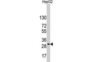 Western blot analysis of CD9 polyclonal antibody  in HepG2 cell line lysates (35 ug/lane). (CD9 Antikörper  (Internal Region))
