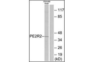 Western blot analysis of extracts from mouse liver cells, using PE2R2 Antibody. (PTGER2 Antikörper  (C-Term))