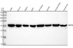 Western blot analysis of Claudin 2/CLDN2 using anti-Claudin 2/CLDN2 antibody (ABIN7603035).