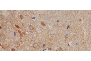 Immunohistochemistry of paraffin-embedded Mouse brain using BCL-x Polyclonal Antibody at dilution of 1:50 (BCL2L1 Antikörper)