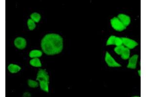Figure:FITC staining on IHC-P Simple: Hela cells (Transportin 1 Antikörper  (AA 593-836))