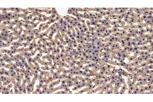 Immunohistochemistry (IHC) image for anti-Complement C2 (AA 473-723) antibody (ABIN7442954)