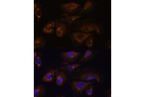 Immunofluorescence analysis of U-2 OS cells using PRSS8 antibody (ABIN7269583) at dilution of 1:100.