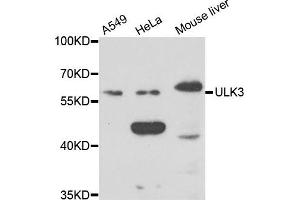 Western blot analysis of extracts of various cell lines, using ULK3 antibody. (ULK3 Antikörper)