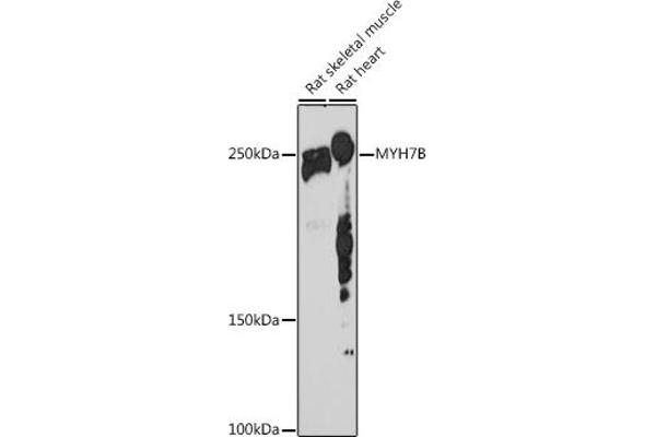 MYH7B antibody
