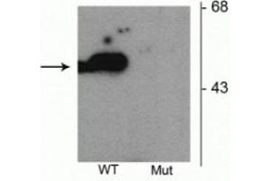 Western blot of HEK293 cells transfected with Parkin wild type (WT) and Parkin S101 mutant (Mut) showing the specific immunolabeling of the ~52 kDa parkin protein phosphorylated at Ser101. (Parkin Antikörper  (pSer101))