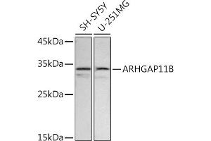 Western blot analysis of extracts of various cell lines, using B antibody (ABIN7269963) at 1:500 dilution. (ARHGAP11B Antikörper  (AA 218-267))