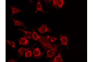 ABIN6268762 staining Hela by IF/ICC. (TDG Antikörper  (Internal Region))