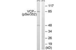 Western blot analysis of extracts from NIH-3T3 cells treated with starved 24h, using VCP (Phospho-Ser352) Antibody. (VCP Antikörper  (pSer352))