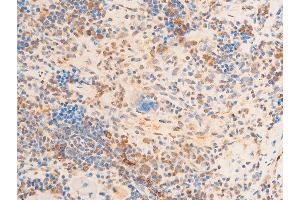 Immunohistochemistry (IHC) image for anti-Lamin A/C (LMNA) (pSer392) antibody (ABIN6256311)