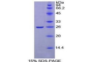 SDS-PAGE analysis of Rat Complement Receptor 2 Protein.