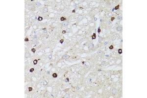 Immunohistochemistry of paraffin-embedded rat brain using MIP antibody at dilution of 1:100 (x40 lens). (MIP Antikörper)