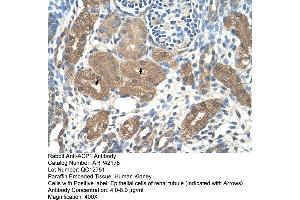 Rabbit Anti-ACP1 Antibody  Paraffin Embedded Tissue: Human Kidney Cellular Data: Epithelial cells of renal tubule Antibody Concentration: 4.