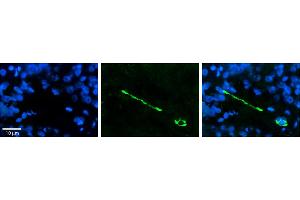 Immunohistochemistry (IHC) image for anti-Microtubule Associated Tumor Suppressor 1 (MTUS1) (Middle Region) antibody (ABIN2781855)