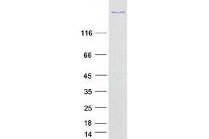 Validation with Western Blot