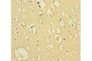 Immunohistochemistry of paraffin-embedded human brain tissue using ABIN7148784 at dilution of 1:100 (CXXC5 Antikörper  (AA 1-227))