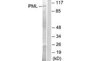 Western blot analysis of extracts from A549 cells, using PML Antibody. (PML Antikörper  (AA 11-60))