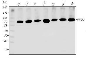 Western blot analysis of METTL3 using anti-METTL3 antibody (ABIN7602808).