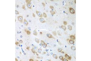 Immunohistochemistry of paraffin-embedded mouse brain using GFM1 antibody at dilution of 1:100 (40x lens). (GFM1 Antikörper)