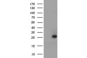 Image no. 1 for anti-Ubiquitin-Conjugating Enzyme E2E 3 (UBE2E3) antibody (ABIN1501619) (UBE2E3 Antikörper)