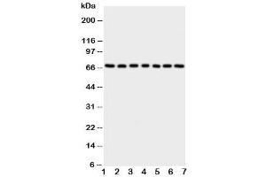 Western blot testing of NOX4 antibody and Lane 1:  rat kidney (NADPH Oxidase 4 Antikörper  (C-Term))