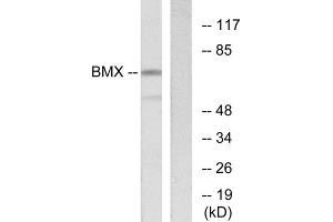 Western blot analysis of extracts from COS-7 cells, using BMX antibody. (BMX Antikörper  (N-Term))