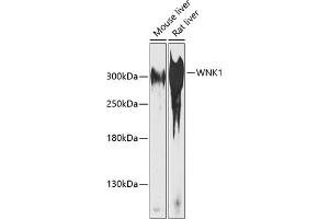 Western blot analysis of extracts of various cell lines, using WNK1 antibody  at 1:1000 dilution. (WNK1 Antikörper  (AA 1-210))