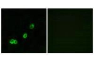 Immunofluorescence analysis of MCF-7 cells, using ACOT1 antibody. (ACOT1 Antikörper)