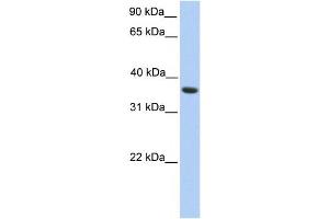 Western Blotting (WB) image for anti-Melanoma Antigen Family A, 4 (MAGEA4) antibody (ABIN2459747) (MAGEA4 Antikörper)
