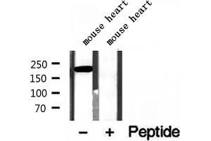 Western blot analysis of extracts of mouse heart tissue, using MYH7-specific antibody. (MYH7 Antikörper  (C-Term))