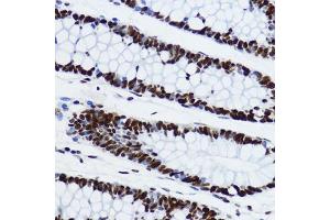 Immunohistochemistry of paraffin-embedded human colon using Acetyl-Histone H3-K9 antibody (ABIN7267675) at dilution of 1:200 (40x lens).