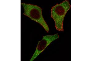 Fluorescent image of Hela cell stained with CDK4 Antibody (C-term) (ABIN391751 and ABIN2841625).